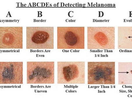 Melanoma Awareness Month